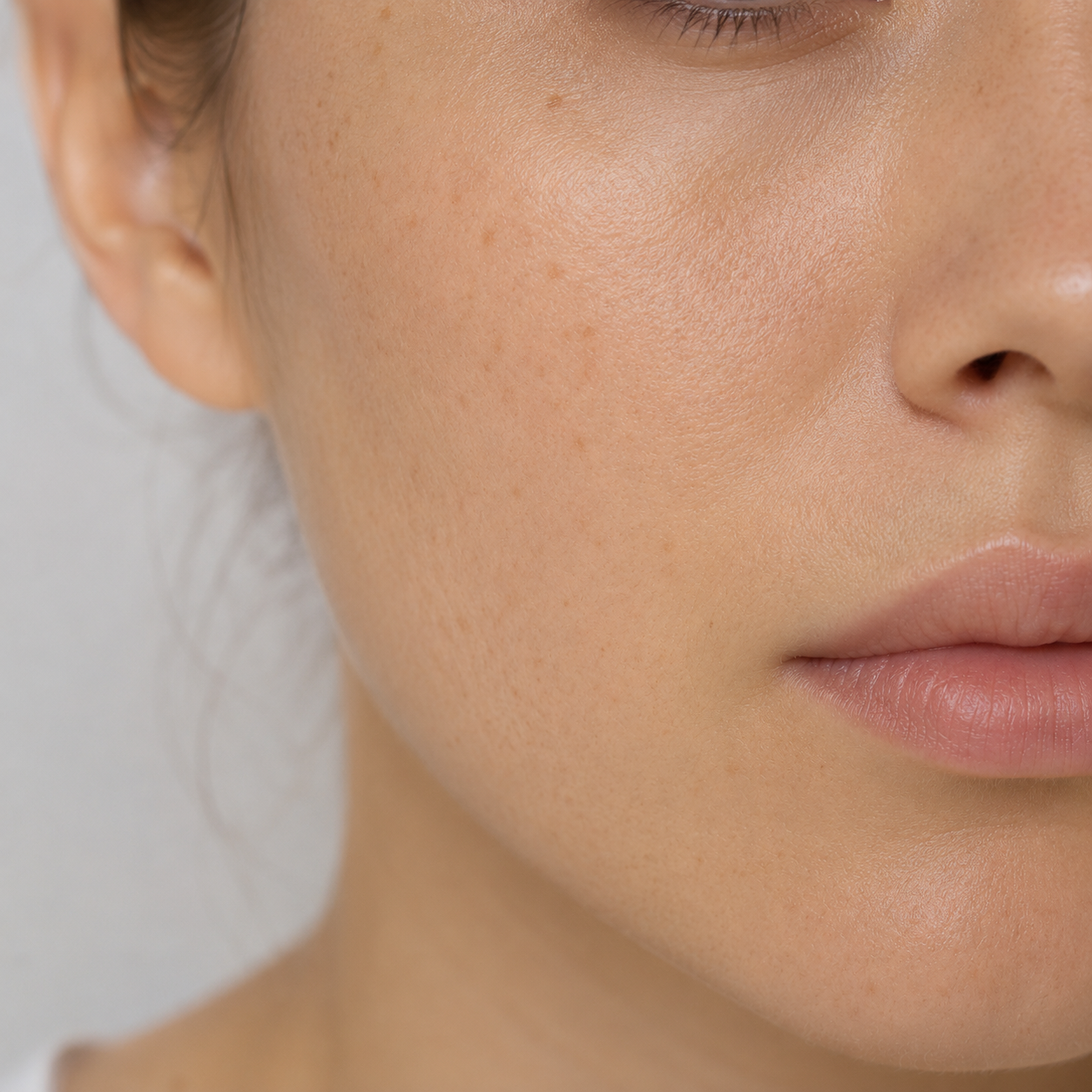 bonakbeauty.de - Hyperpigmentierung der Haut: Ursachen, Pflege & wirksame Wirkstoffe - 1